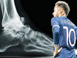 Neymar Soccer Career At Risk After Suffering Ankle Ligament Damage
